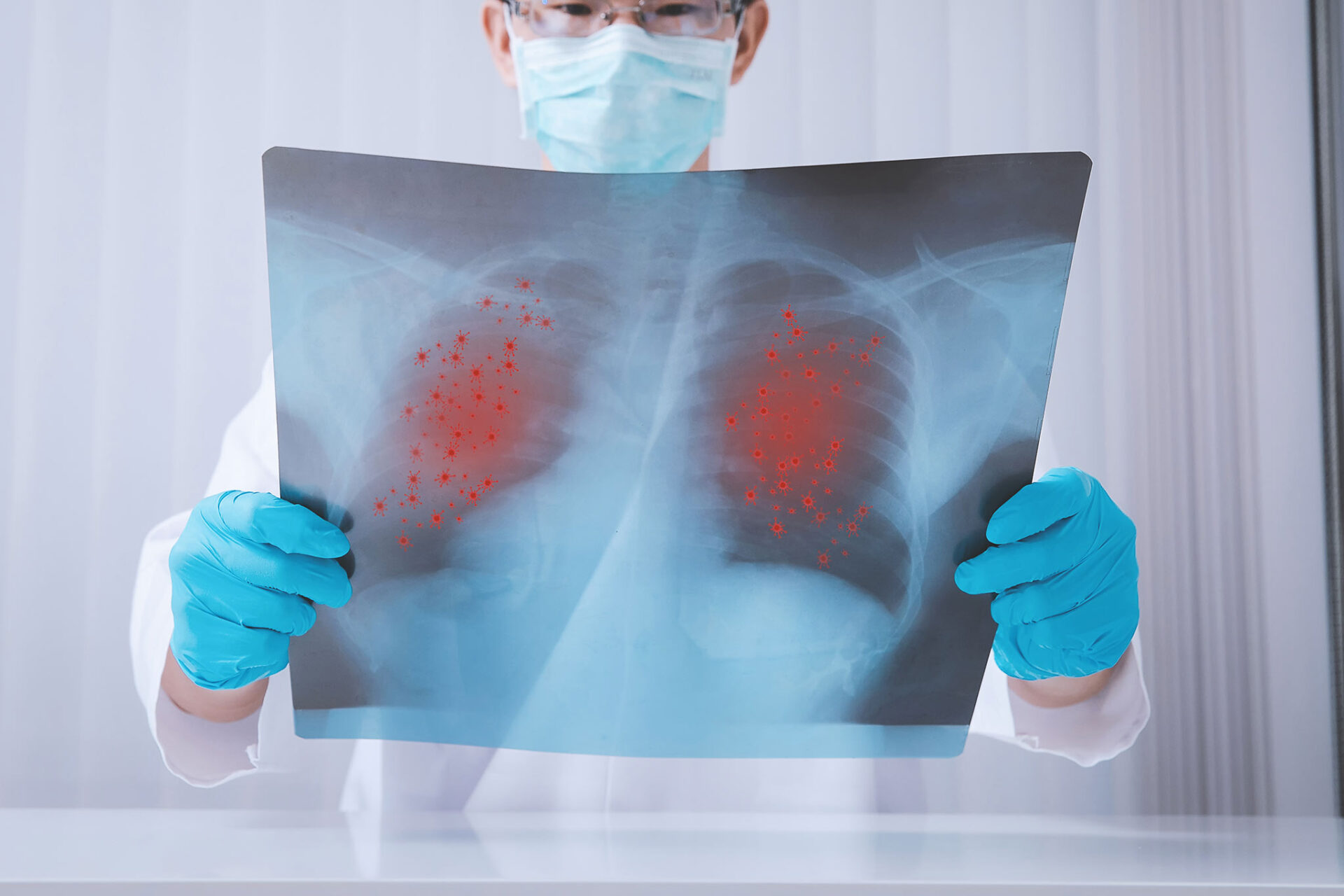 มะเร็งปอด มะเร็งปอด